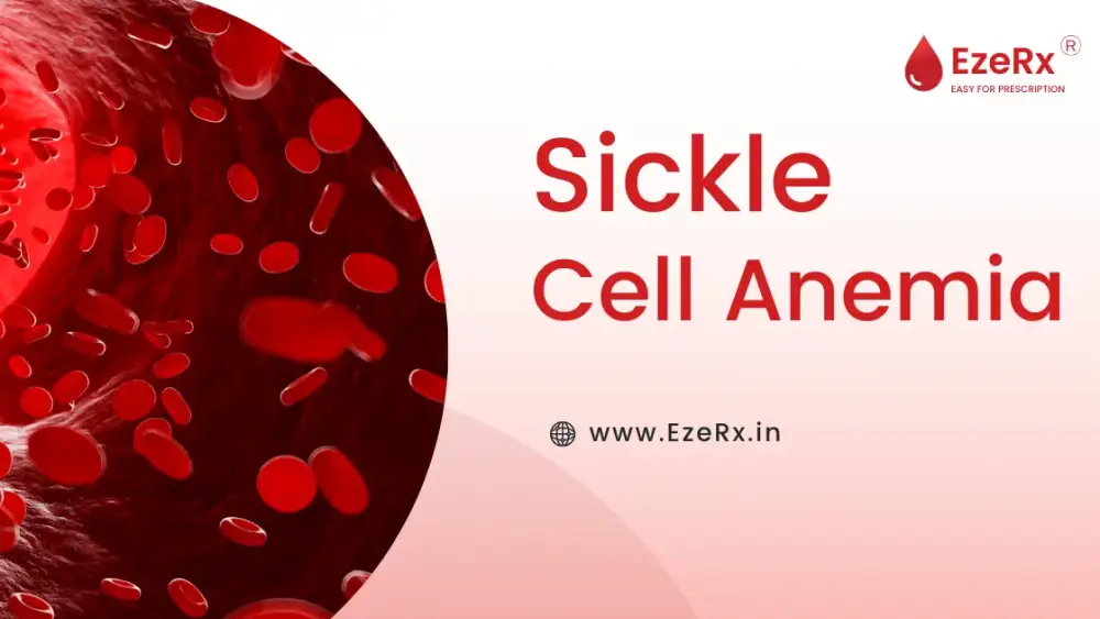 Comprehensive Guide to Sickle Cell Anemia: Causes, Symptoms, Treatments, and Effective Management Strategies